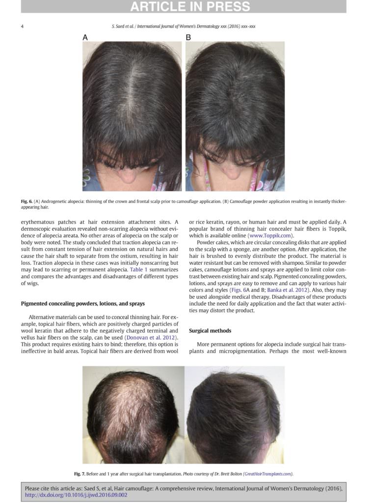 Hair Transplant Anxiety? - Dr. Brett Bolton's Latest News